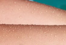 Rešite se celulita na brz i prirodan način